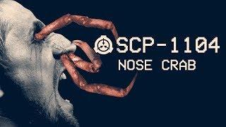 SCP-1104 - Nose Crab  : Object Class - Keter : Parasitic SCP