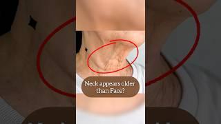 Anti-gravity Neck exercise to reverse Tech neck, Turkey neck, shortening neck, neck lines🫨