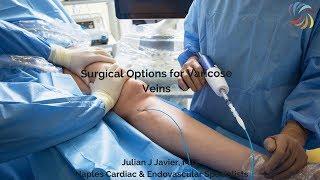 Minimally Invasive & Other Options for Varicose Veins with Dr. Javier