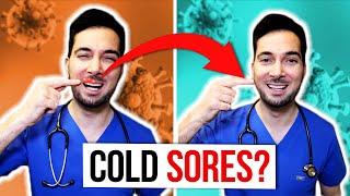 How to get rid of cold sores on lips fast and treatment