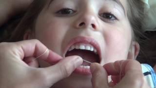 Flossing technique: toddler & child