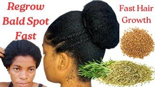 Hair Grows Insanely Fast Grow Thick and Long Hair | Extreme Hair Growth