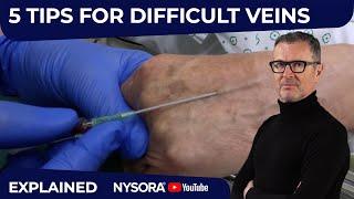 DIFFICULT IV: 5 TIPS TO KNOW