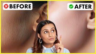 How To Remove Hair From Face Permanently At Home | How To Take Care Of Face Naturally | Glamrs