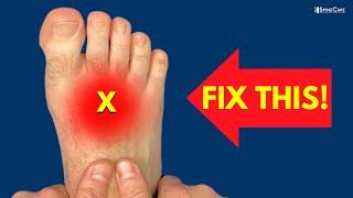 How to Fix Pain on the TOP of the Foot