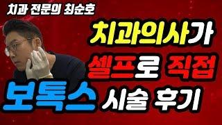 치과의사 최순호가 셀프로 직접 보톡스 주사 시술한 후기 !