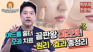 [여드름 흉터 정복 3탄!] 여드름 흉터/모공 치료 끝판왕 미라젯! 원리, 효과, 가격 총정리