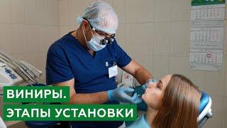 Виниры. Этапы установки виниров