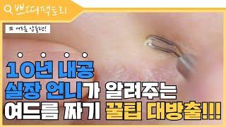 여드름 압출, 집에서 고대로~ 따라하세요