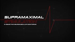 Supramaximal Stimulation in Objective Neuromuscular Monitoring