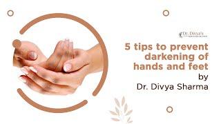 5 tips to prevent darkening of hands and feet | Dr. Divya Sharma