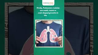 Understanding Pulmonary Nodules: Causes, Symptoms, and More | Horizon Hospitals