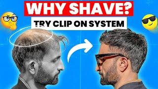 Clip-on Hair Volumizers (For Men) | Game-Changer | Instant Volume