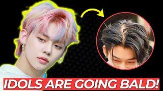 K-Pop Hair Pandemic - K-Pop Idols Are Going Bald