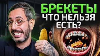 Эти 5 продуктов НЕЛЬЗЯ есть, когда носишь БРЕКЕТЫ