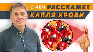 ГЕМОСКАНИРОВАНИЕ. Диагностика Крови на Темнопольном Микроскопе. АНАЛИЗ КРОВИ на инфекции и паразитов