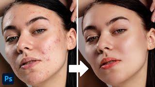 High-End Skin Softening in 2 Minute in Photoshop |  photoshop tutorial