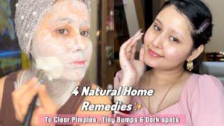 HOW TO MAINTAIN CLEAR SKIN WITHOUT SPENDING MONEY| To Remove Acne,Dark spots & Dull Skin