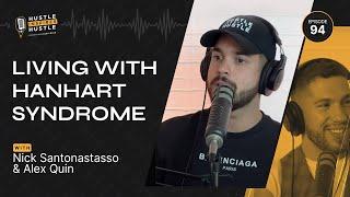 Living with Hanhart Syndrome // Nick Santonastasso // Hustle Inspires Hustle Podcast