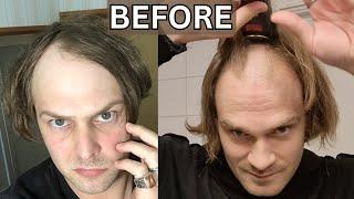 BALDING MEN With LONG HAIR GO BALD - BEST TRANSFORMATIONS