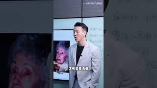 为什么不推荐做颧骨内推