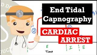 End Tidal Capnography in Cardiac Arrest - Improving Chest Compressions, Predicting ROSC, Prognosis