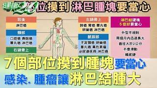 7個部位摸到腫塊要當心 感染、腫瘤讓淋巴結腫大 健康2.0