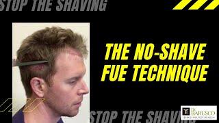 Stop the Shaving!! "No-Shave" FUE Hair Transplant