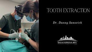 Dental Care: Tooth Extraction with Dr. Danny Sanovich