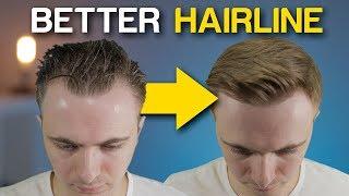 5 POWERFUL Receding Hairline Tricks To INSTANTLY Improve Your Look