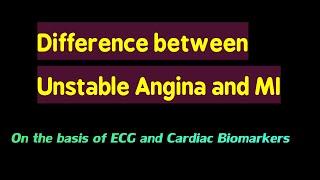 Five Differences b/w Unstable Angina And MI On The Basis Of ECG And Cardiac Enzymes| STEMI | NSTEMI