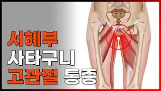 서혜부통증 사타구니 불편감 과연 디스크 증상일까?