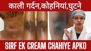 1 क्रीम सारी प्रोब्लम के लिए  | OJAS by Dr Shaista Khan #trending #skin #body