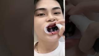 powerful teeth whitening #part2