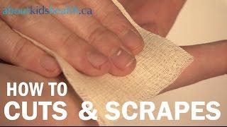 How to treat cuts and scrapes / Comment traiter les coupures et les éraflures | SickKids