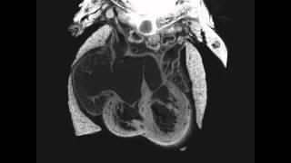 [51959]019-005-LD coronal.mov