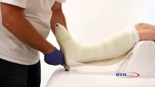 Application technique of Cutimed Total Contact Cast