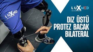 Bilateral Above Knee Prosthetic | Luxmed Protez