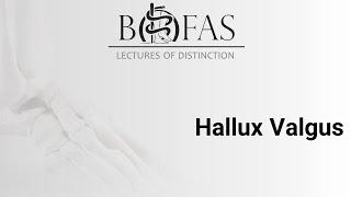 Hallux Valgus - BOFAS Lectures of Distinction