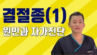 결절종 원인과 자가 진단(Ganglion Cysts: Causes & Diagnosis)