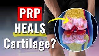 The Truth About PRP Injections & Cartilage Regeneration