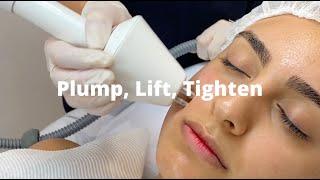 Plump, lift and tighten with Non Surgical Lifts | By Results Laser Clinic