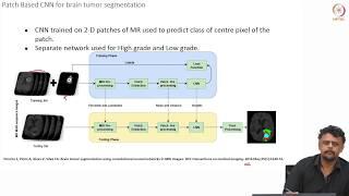 Segmentation of Brain Tumors from MRI using Deep Learning