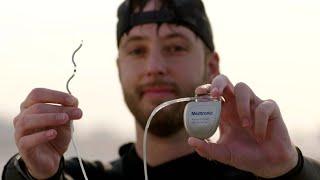 Harrison's story: Living with the Medtronic EV-ICD™ system