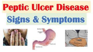 Peptic Ulcer Disease Signs & Symptoms | Gastric vs. Duodenal Ulcers