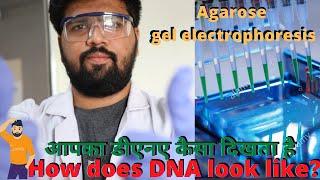 How does DNA look like ? Agarose gel electrophoresis