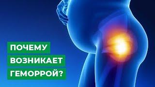 Почему возникает геморрой?