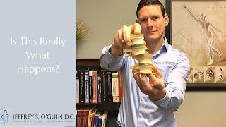 Do bones really go out of place? | What do chiropractors do?