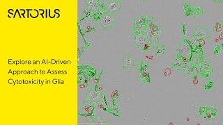 Webinar (Preview): Label-Free AI-Driven Analysis of Chemotherapeutic Cytotoxicity in Glia