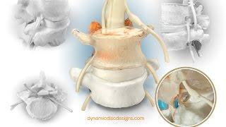 Dynamic Disc Designs Corp. | Spine Education Models